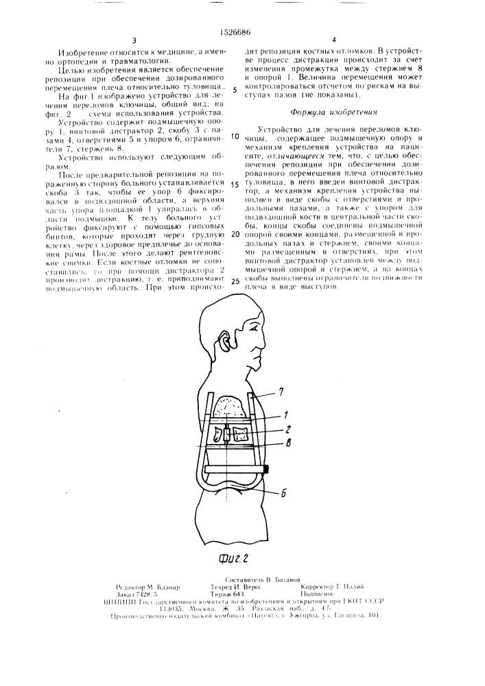 Устройство для лечения переломов ключицы (патент 1526686)