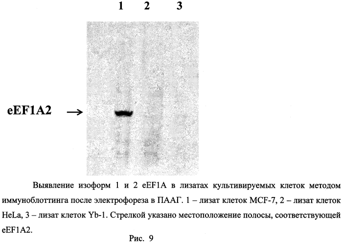 Синтетический пептид для получения моноспецифичных антител против изоформы 2 эукариотического фактора элонгации трансляции 1а (патент 2562880)