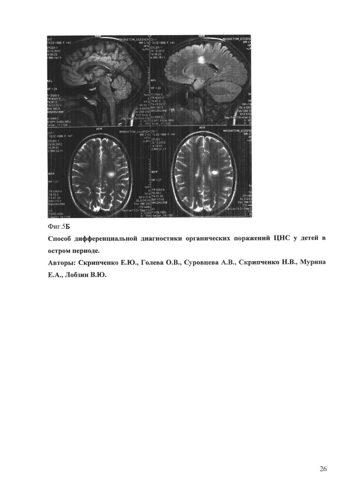 Способ дифференциальной диагностики органических поражений цнс у детей в остром периоде (патент 2648215)