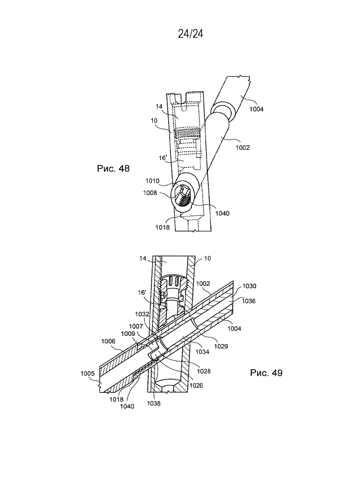 Увеличиваемый вертельный бедренный штифт (патент 2601982)