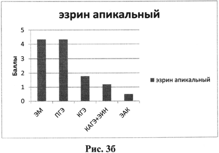 Способ дифференциальной диагностики высокодифференцированной эндометриоидной аденокарциномы тела матки у пациенток перименопаузального периода (патент 2561677)