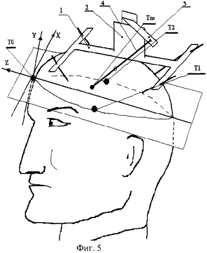 Способ наведения стереотаксического инструмента на целевую точку головного мозга (патент 2257178)