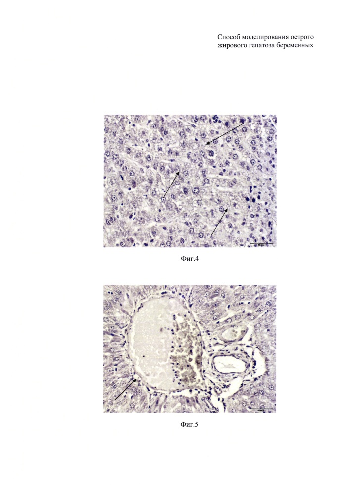Способ моделирования острого жирового гепатоза беременных (патент 2610536)