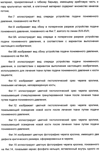 Устройство для лечения путем подкожной подачи пониженного давления с использованием текучей магистрали и связанный с ним способ (патент 2405459)