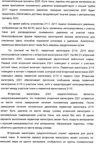 Устройство для лечения путем подкожной подачи пониженного давления с использованием разделения с помощью воздушного баллона (патент 2401652)