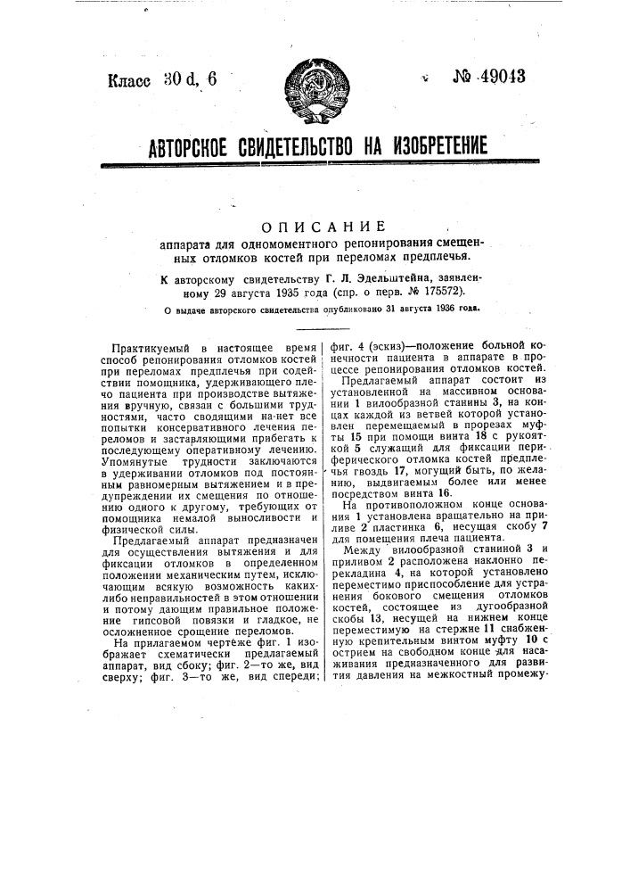 Аппарат для одномоментного репонирования смещенных обломков костей при переломах предплечья (патент 49043)