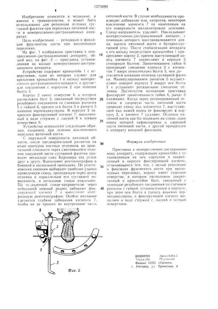 Приставка к компрессионно-дистракционному аппарату (патент 1273090)