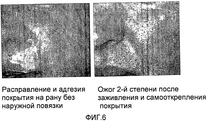 Стерильный аутологичный, аллогенный или ксеногенный имплантат и способ его изготовления (патент 2478403)