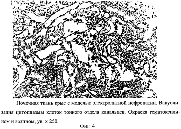 Способ моделирования электролитной нефропатии у крыс (патент 2256953)