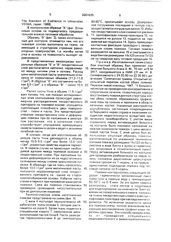 Медицинская повязка (патент 2001635)