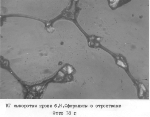 Способ экспресс-диагностики эндогенной интоксикации (патент 2280865)