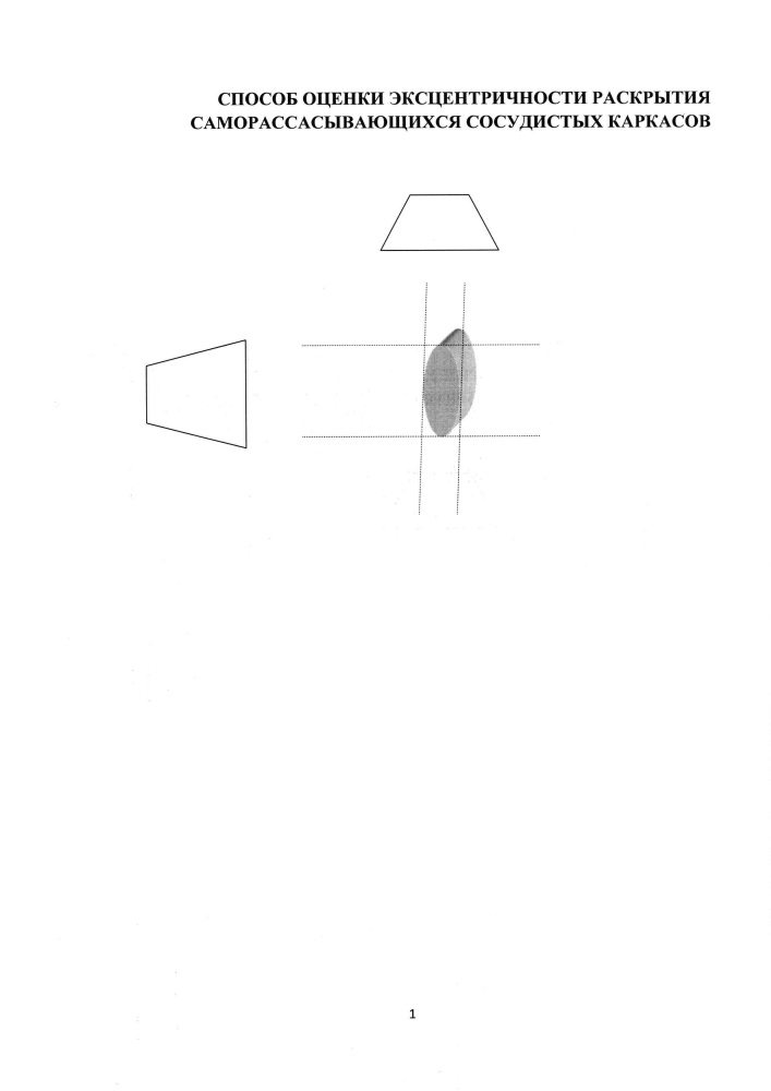 Способ оценки эксцентричности раскрытия саморассасывающихся сосудистых каркасов (патент 2617171)