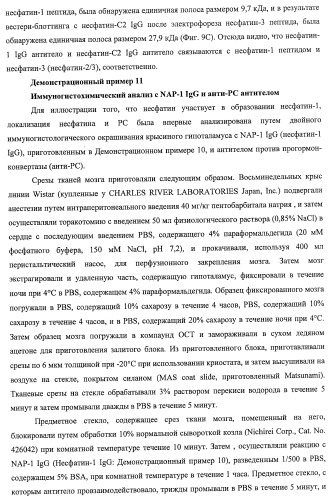 Способ получения фактора, связанного с контролем над потреблением пищи и/или массой тела, полипептид, обладающий активностью подавления потребления пищи и/или прибавления в весе, молекула нуклеиновой кислоты, кодирующая полипептид, способы и применение полипептида (патент 2418002)