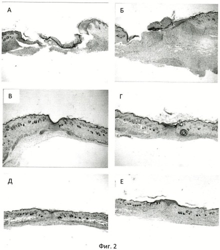 Способ стимуляции регенерации дефектов кожи и слизистых оболочек и лекарственное средство для его реализации (патент 2447082)