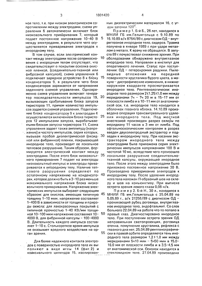 Способ удаления внутриглазных металлических инородных тел (патент 1801420)