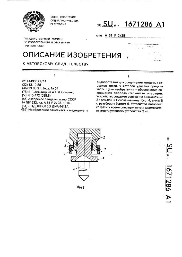 Эндопротез диафиза (патент 1671286)