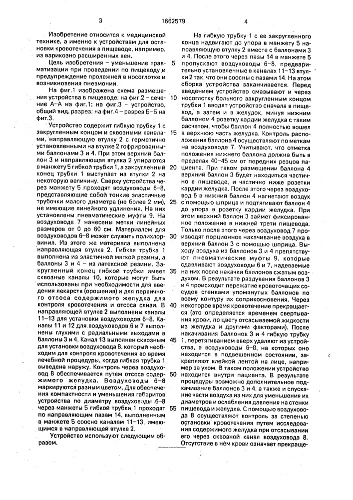 Устройство для остановки кровотечения в пищеводе (патент 1662579)