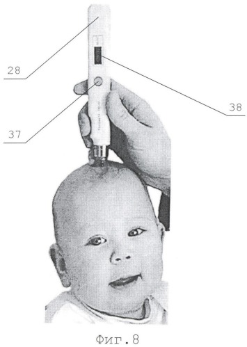 Устройство для измерения внутричерепного давления у новорожденных и детей грудного возраста и опорный элемент для этого устройства (патент 2372023)