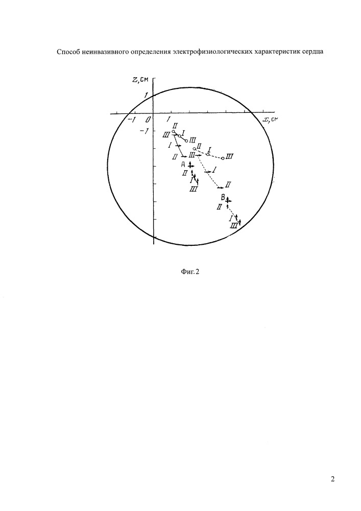Способ неинвазивного определения электрофизиологических характеристик сердца (патент 2651068)