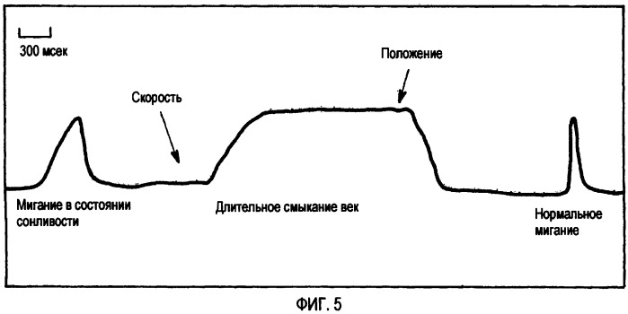 Измерение бдительности (патент 2423070)