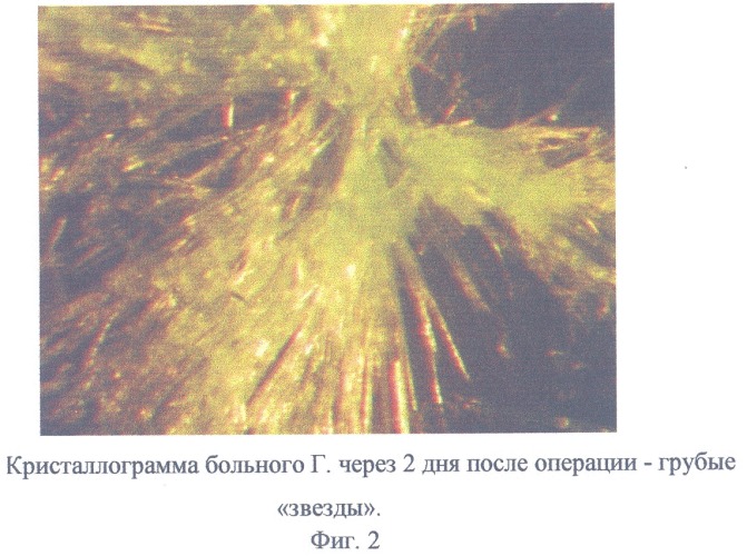 Способ прогнозирования возможных осложнений после вскрытия верхнечелюстной пазухи (патент 2317542)