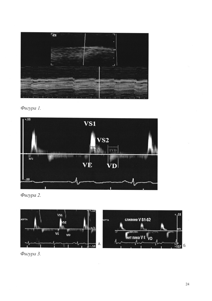 Способ определения маркеров раннего и позднего ремоделирования супраренального и инфраренального отделов аорты у пациентов с разной степенью артериальной гипертензии ультразвуковыми методами (патент 2638463)