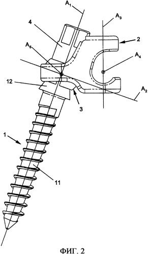 Имплантат для костного закрепления с многоосевой головкой и способ установки имплантата (патент 2361538)