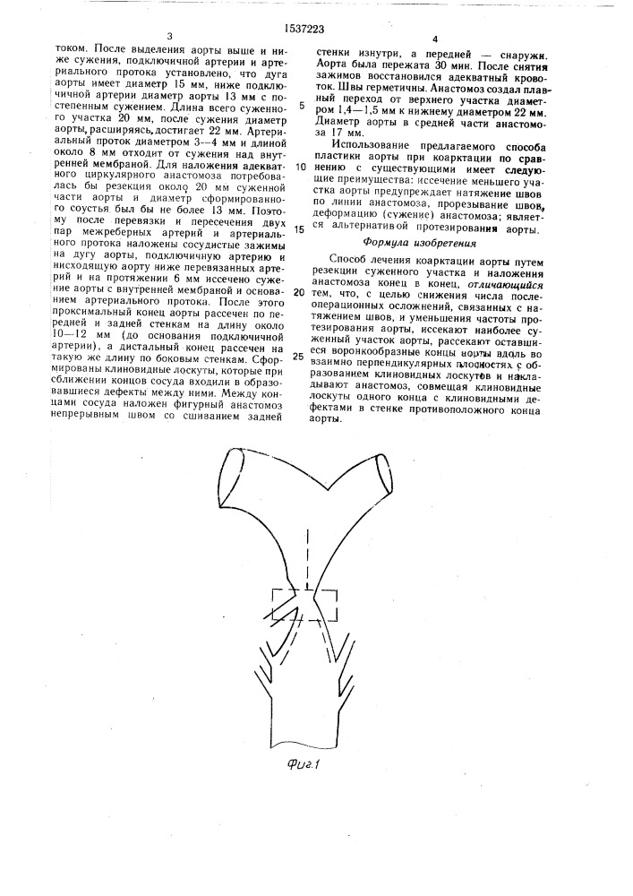 Способ лечения коарктации аорты (патент 1537223)