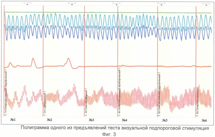 Способ диагностики расстройств сексуальных предпочтений (патент 2406441)