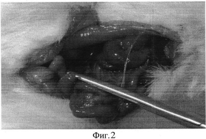 Способ лечения инфекционного перитонита в эксперименте (патент 2553342)