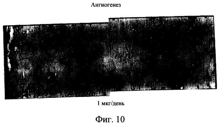 Производные пентадикарбоновой кислоты, фармацевтическая композиция на их основе и способы лечения (патент 2268881)