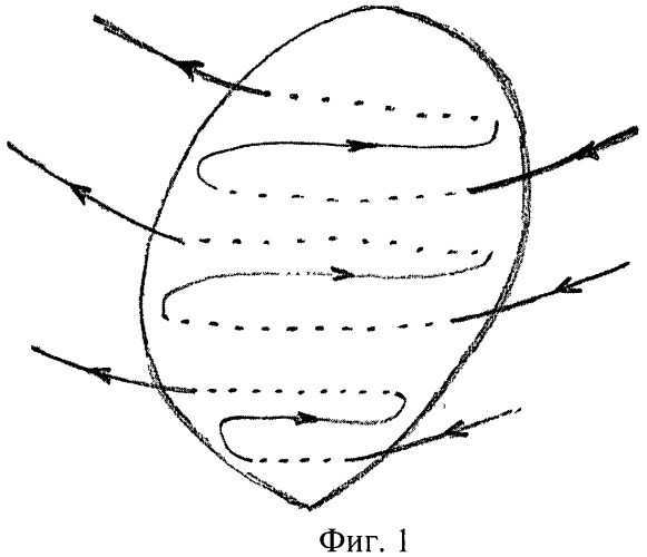 Способ ушивания ложа миоматозного узла после консервативной миомэктомии во время беременности (патент 2482798)