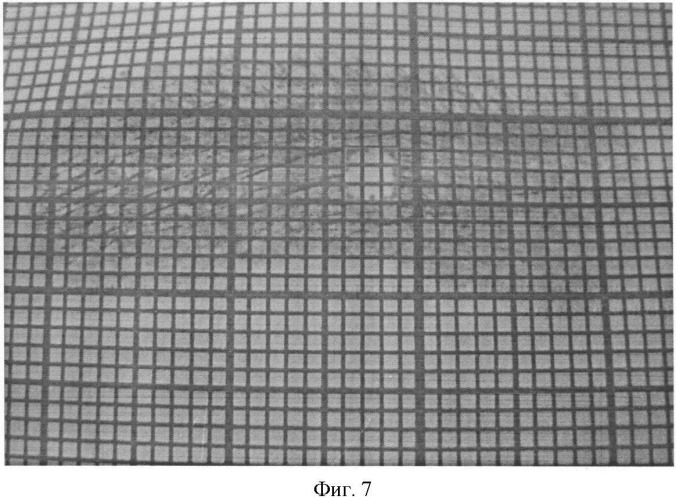 Способ определения линейных размеров и площади поверхностной проекции атрофического рубца кожи (патент 2443391)