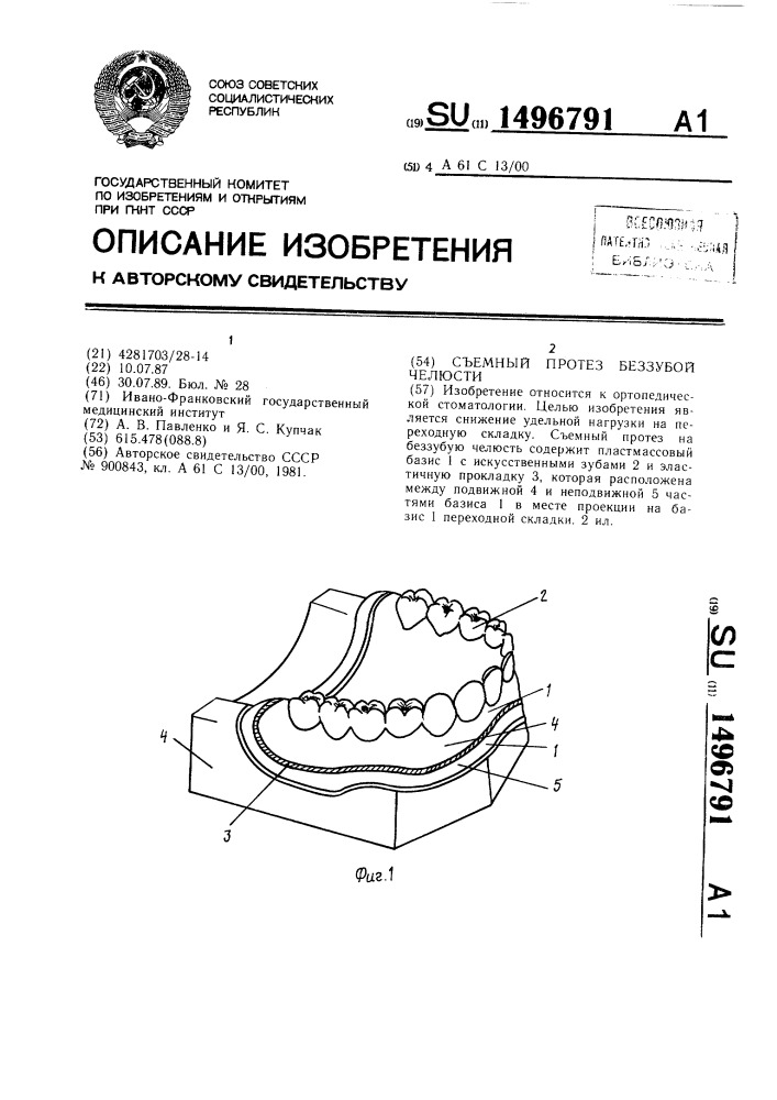 Съемный протез беззубой челюсти (патент 1496791)
