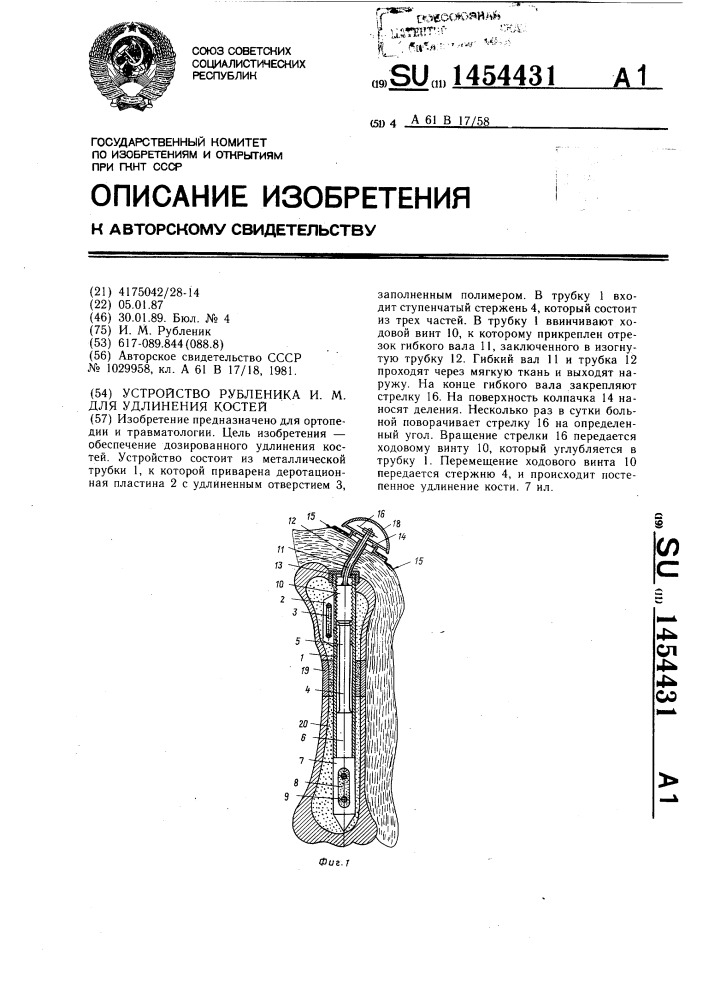 Устройство рубленика и.м. для удлинения костей (патент 1454431)