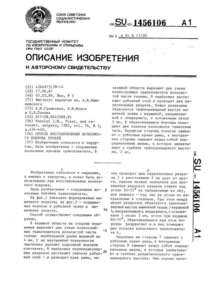 Способ восстановления волосяного покрова бровей (патент 1456106)