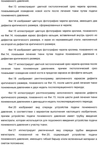 Устройство для лечения путем подкожной подачи пониженного давления с использованием разделения с помощью воздушного баллона (патент 2401652)