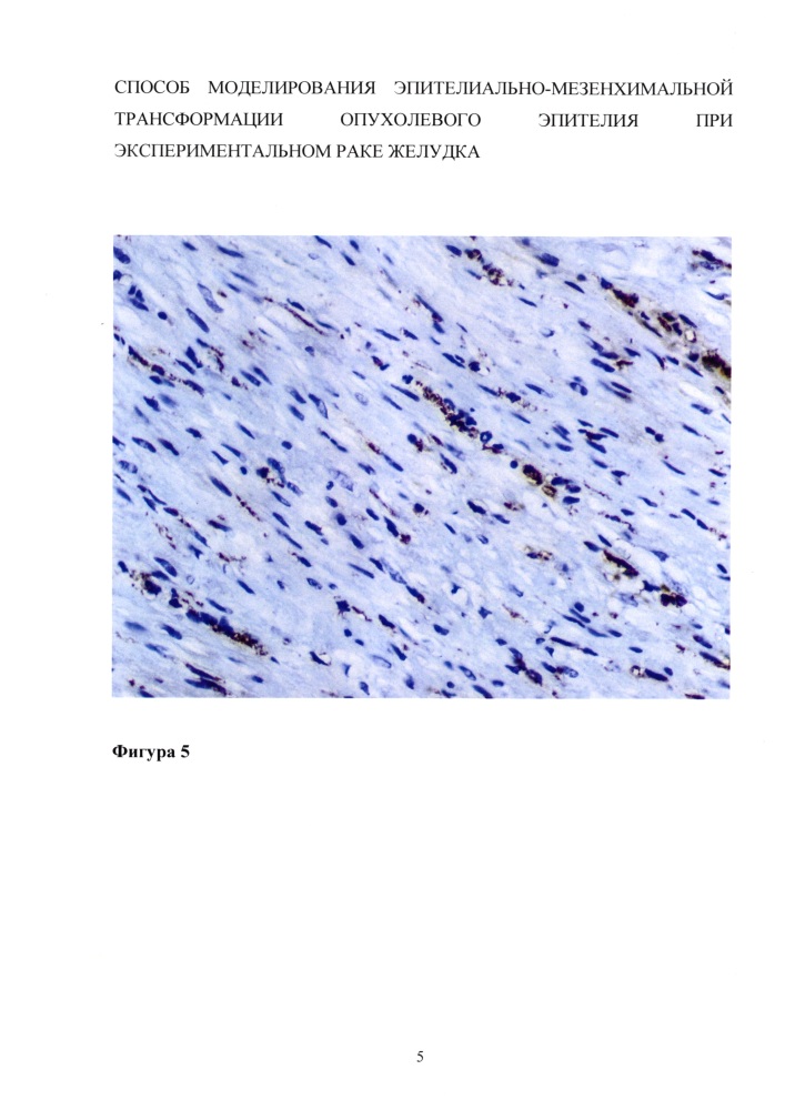 Способ моделирования эпителиально-мезенхимальной трансформации опухолевого эпителия при экспериментальном раке желудка (патент 2626717)