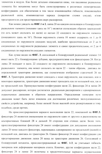 Стент из скользящих и блокирующих элементов (патент 2429801)