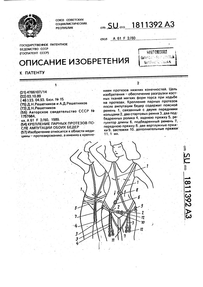 Крепление парных протезов после ампутации обоих бедер (патент 1811392)
