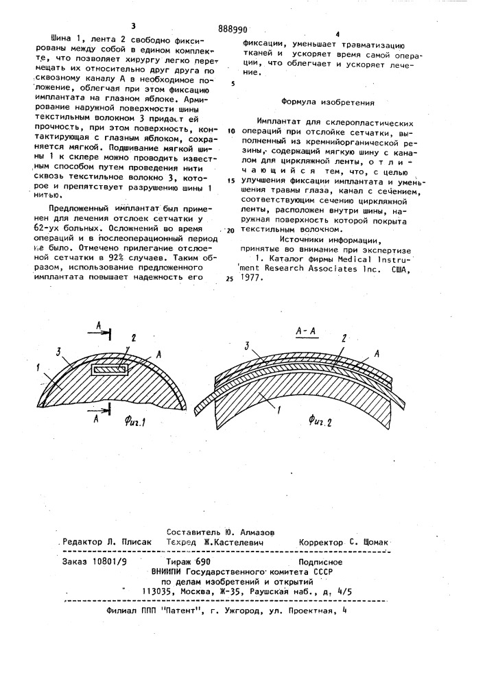 Имплантат для склеропластических операций при отслойке сетчатки (патент 888990)