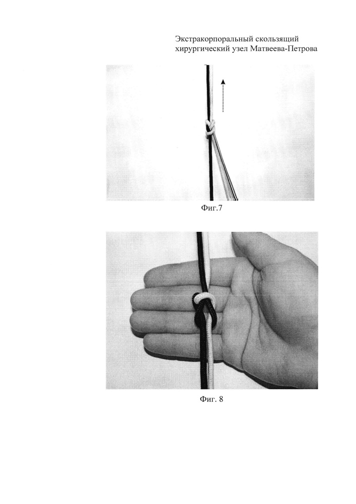 Экстракорпоральный скользящий хирургический узел матвеева-петрова и способ его завязывания (патент 2619751)
