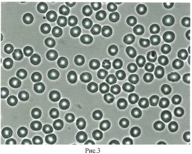Способ оценки состояния цитоскелета эритроцитов (патент 2572335)