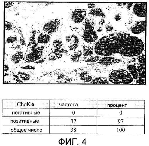 Способ in vitro определения прогноза развития заболевания у больного раком и способ in vitro мониторинга эффекта терапии, назначаемой больному раком (патент 2434946)