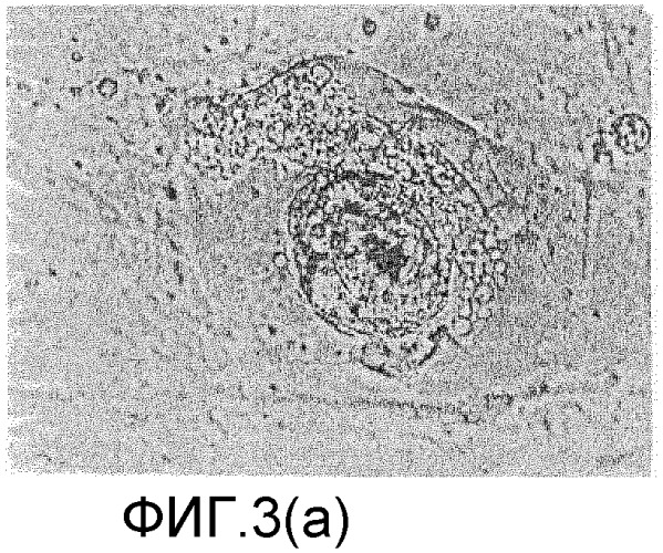Выделение внутренней клеточной массы для создания линий эмбриональных стволовых клеток человека (hesc) (патент 2291703)