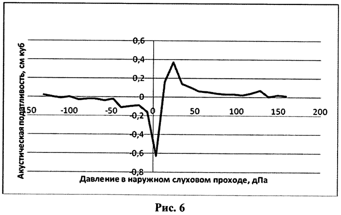 Способ диагностики внутричерепной гипертензии у детей (патент 2570545)