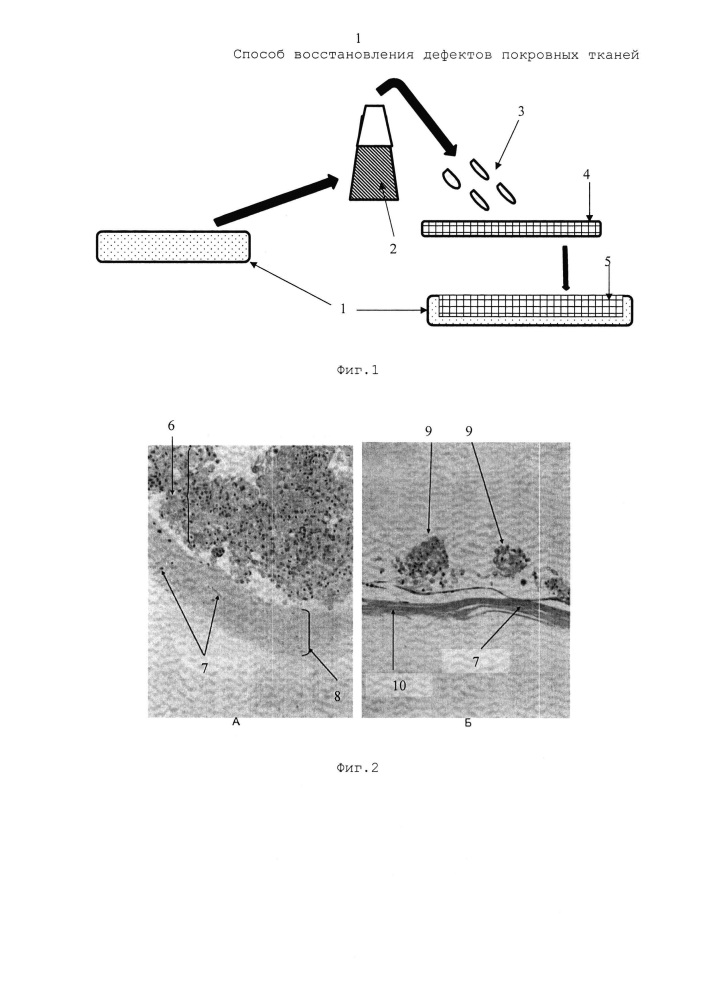 Способ восстановления дефектов покровных тканей (патент 2644306)
