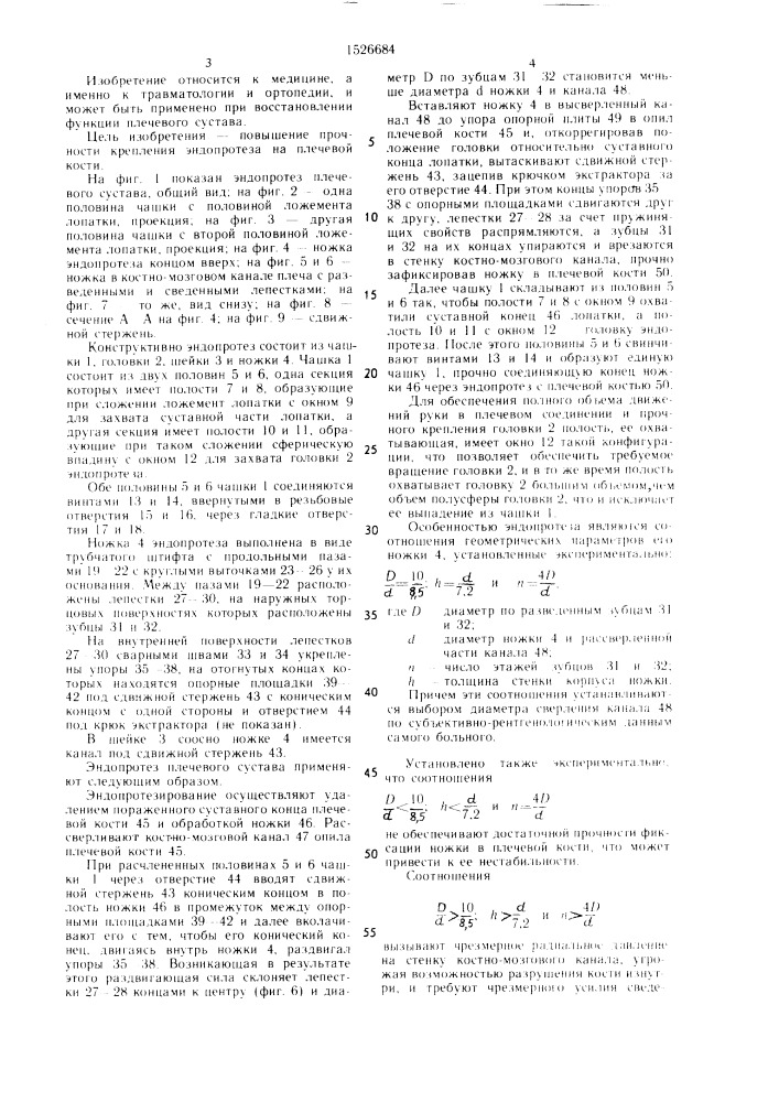 Эндопротез плечевого сустава (патент 1526684)