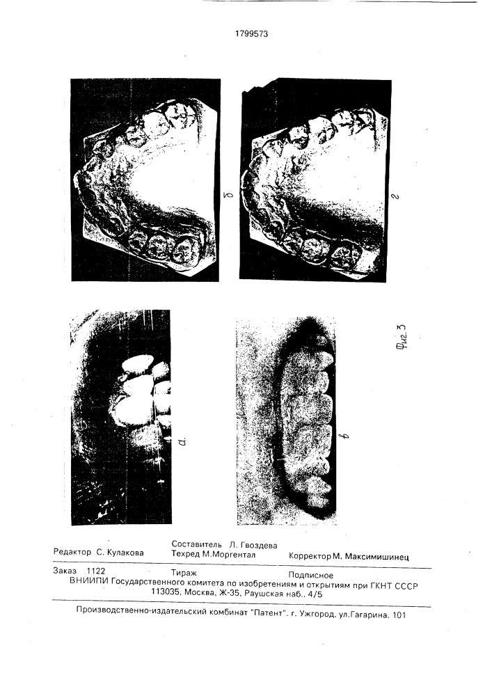 Способ лечения зубочелюстных аномалий (патент 1799573)