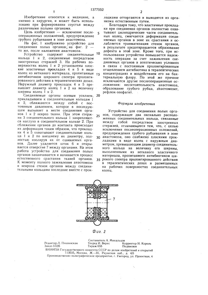Устройство для соединения полых органов (патент 1377052)